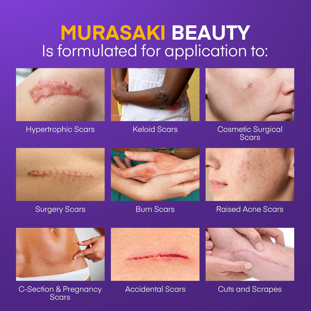 MURASAKI BEAUTY scar gel with SPF 30 protects healing scars.