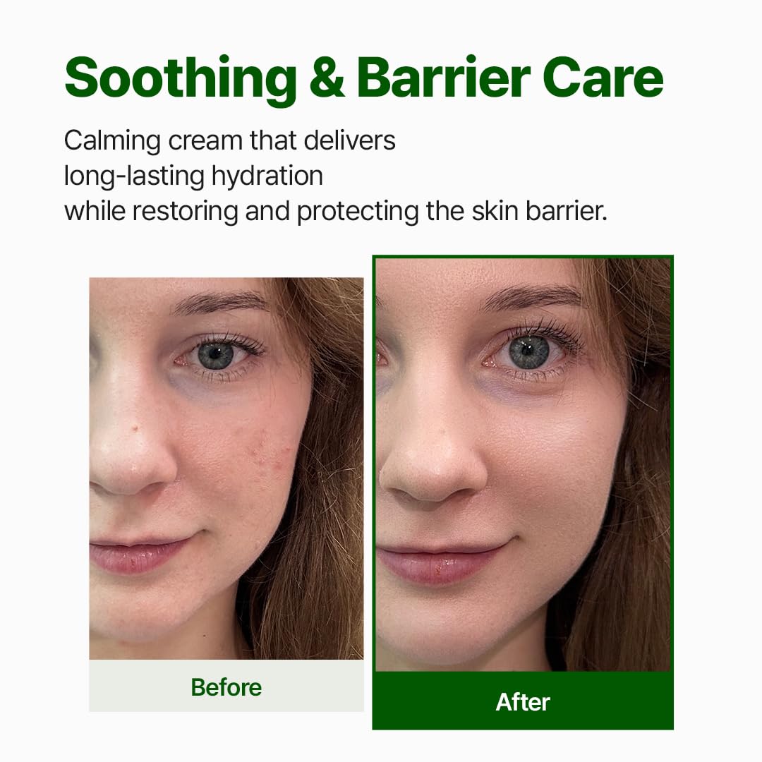 NACIFIC Cica PDRN Barrier Cream applied to skin