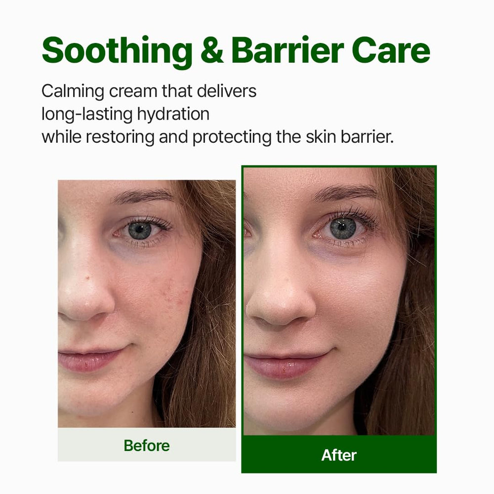 NACIFIC Cica PDRN Barrier Cream applied to skin
