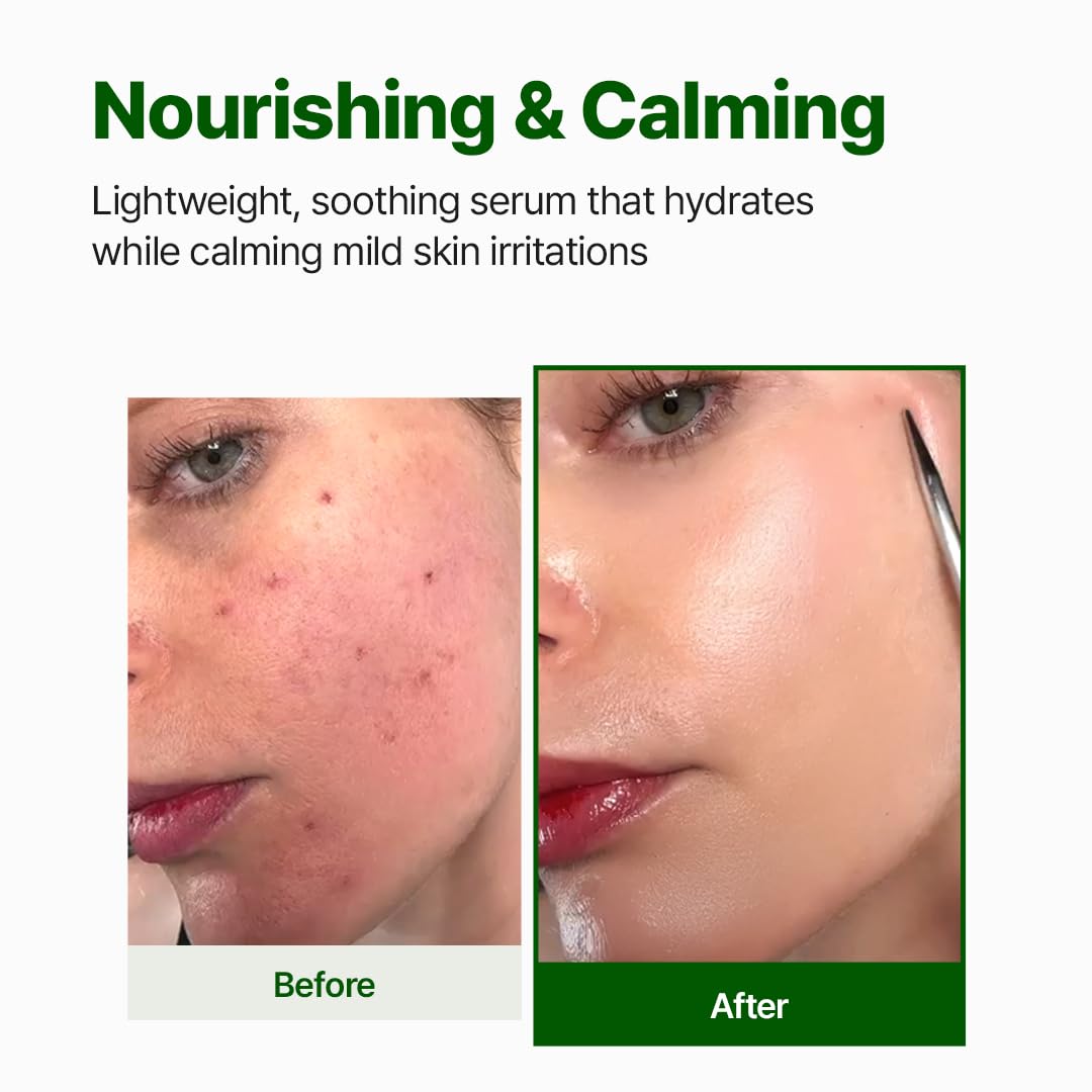 Golden-tinged serum highlights Centella richness and skin-calming potential.