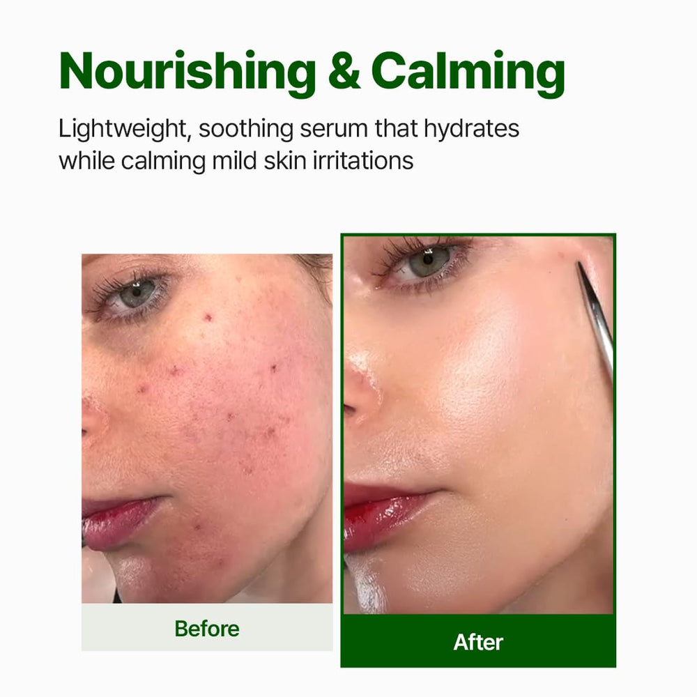 Golden-tinged serum highlights Centella richness and skin-calming potential.
