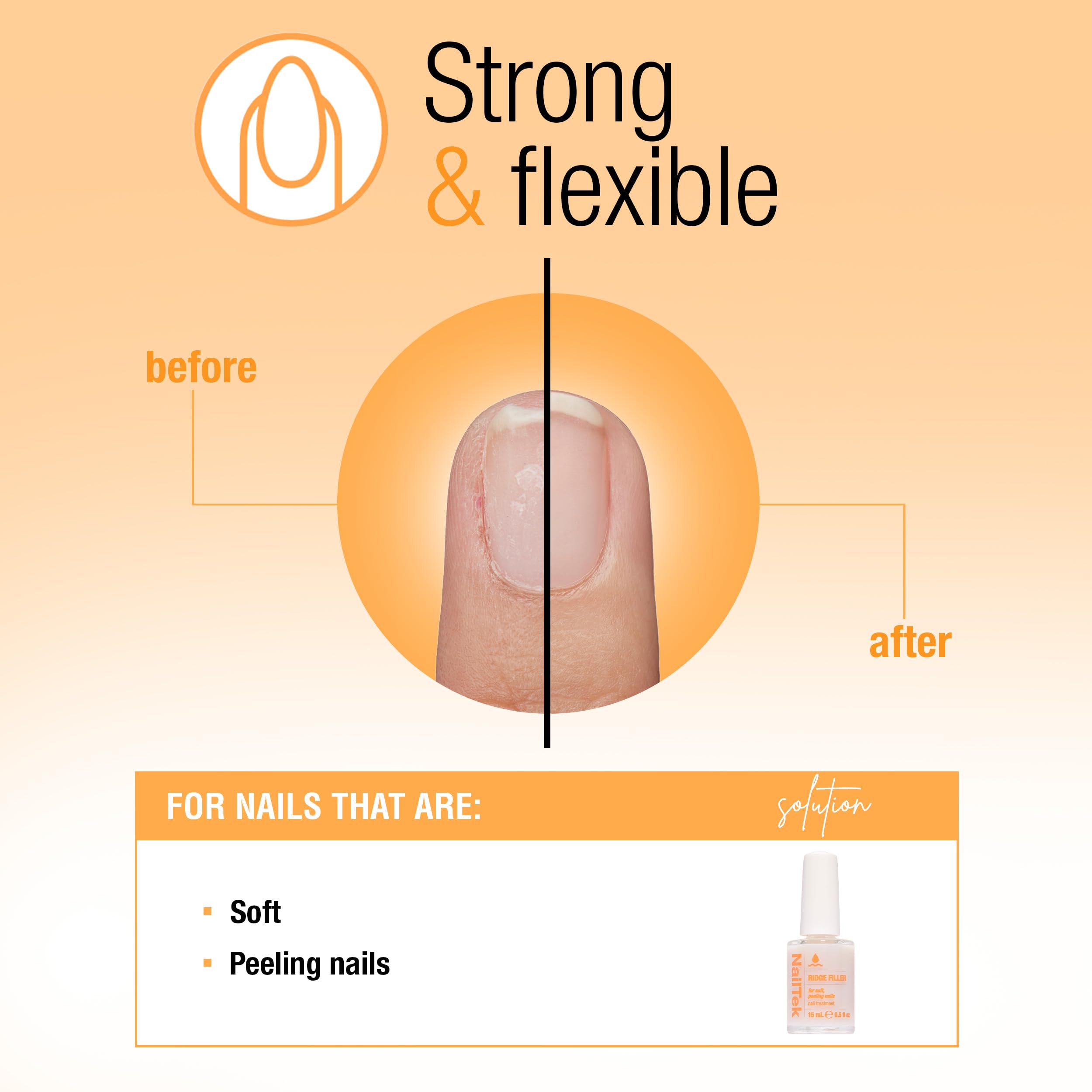 Nail Tek Ridge Filler Formula 2 nails before with uneven texture and peeling.