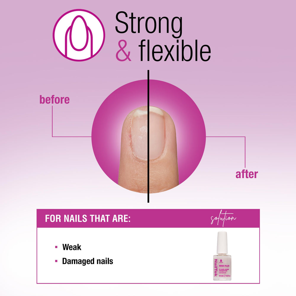Nail Tek Ridge Filler 4 nail surface after application appears smooth and ready for color.
