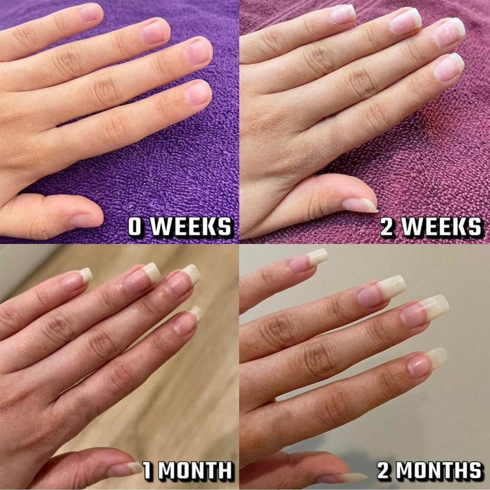 Nailz Growth Pen close-up shows nourishing care at the nail edge.