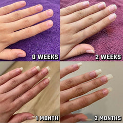 Nailz Growth Pen close-up shows nourishing care at the nail edge.