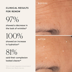 Naked & Thriving Revive Eye Cream closeup around the eyes for firmness.