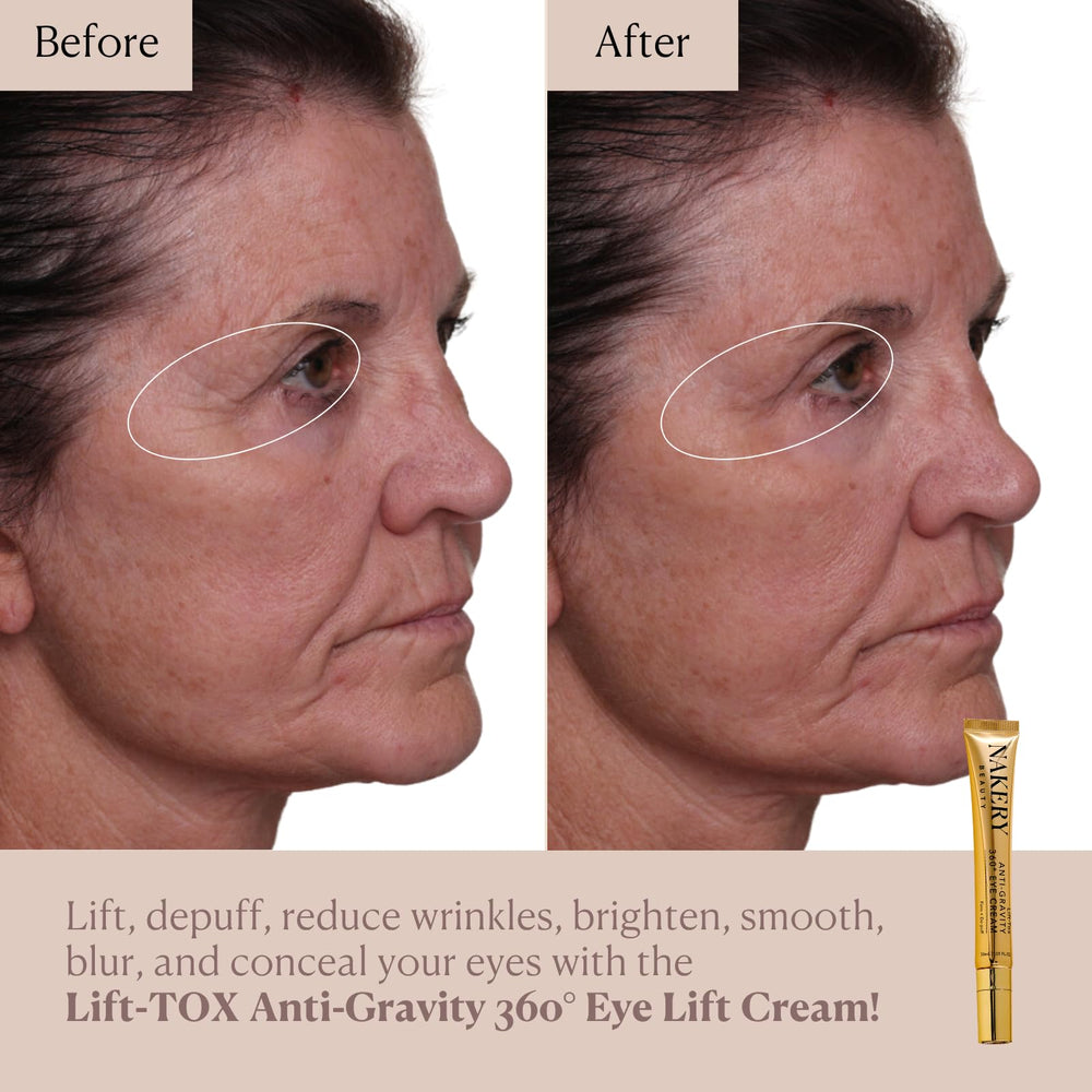 Nakery Lift-Tox Eye Cream applied under the eye for lift and depuffing.