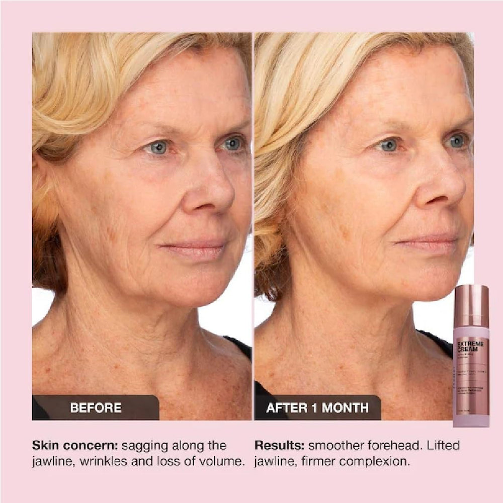 NAPH iNNBEAUTY PROJECT Extreme Cream visibly firms and lifts facial contours