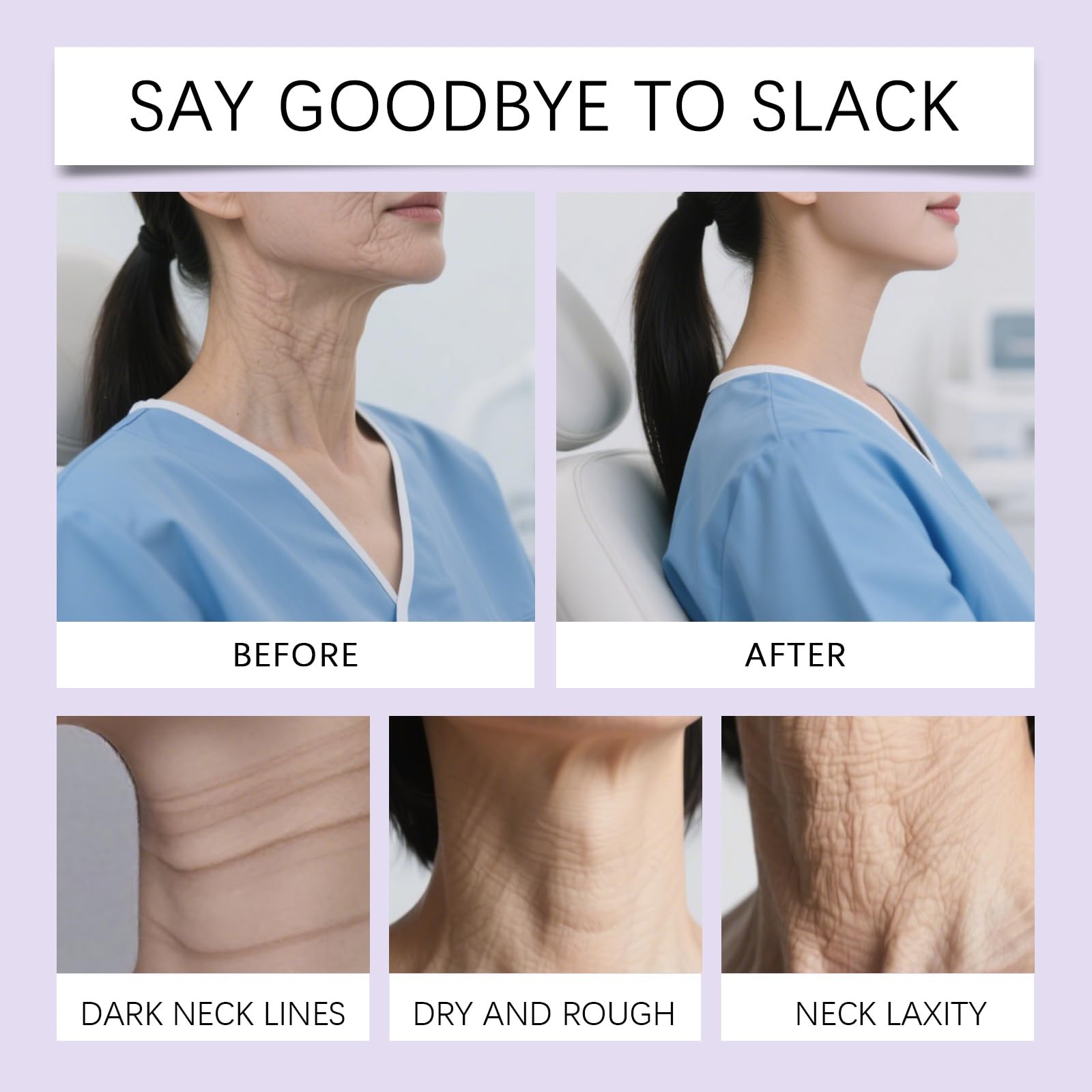 Nascence neck lift tape neck contour shows firmer neck silhouette