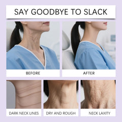 Nascence neck lift tape neck contour shows firmer neck silhouette