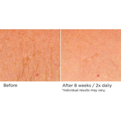 NassifMD Deco-Lift neck and décolletage glow with smooth texture