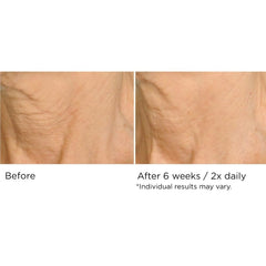 NassifMD Deco-Lift serum tube showing lightweight gel that absorbs quickly