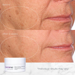 Travel-friendly NassifMD pads ideal for on-the-go skincare routines
