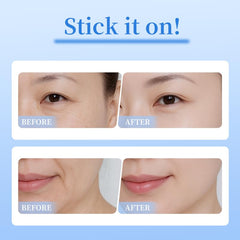 Natener patch adheres securely to the under-eye area for easy application