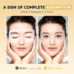 Natener patches applied under the eye on a calm face for puffiness-ready look.