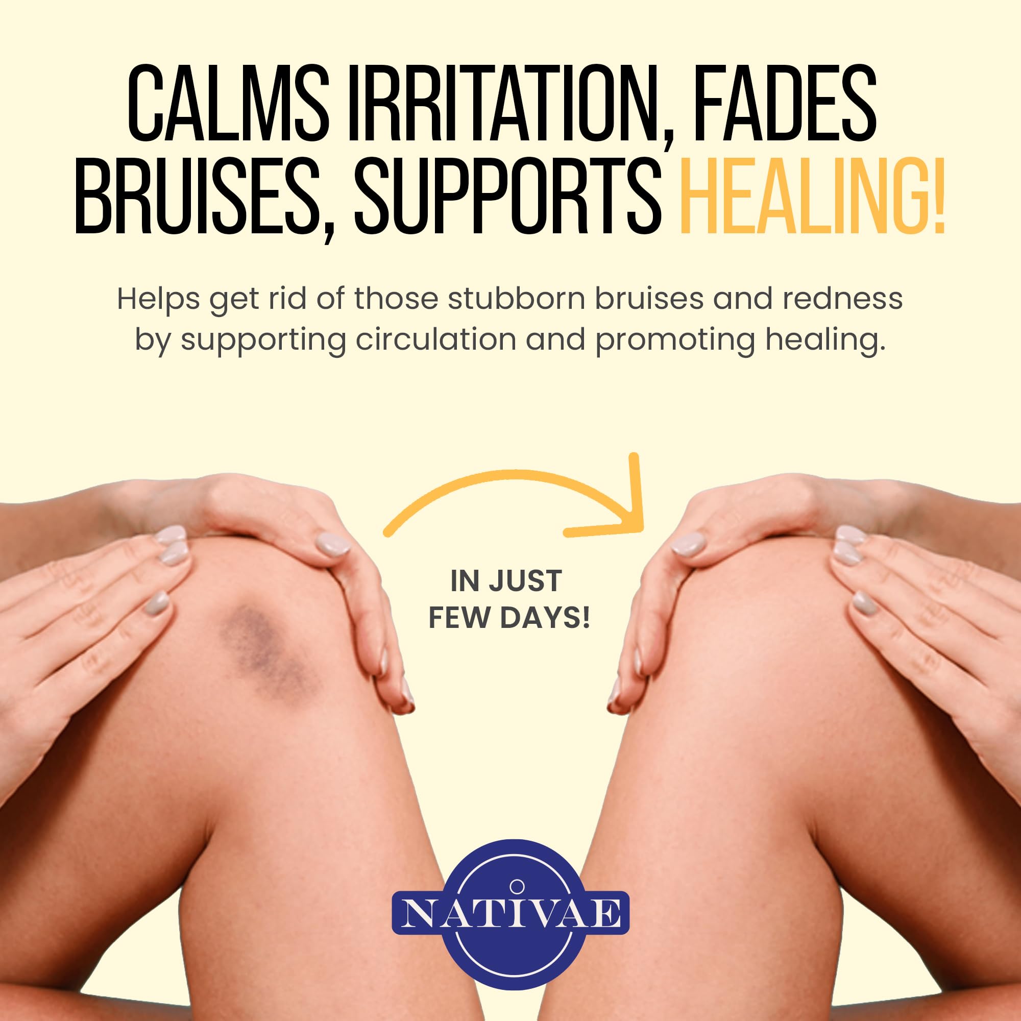 Packaging display of Nativae Helichrysum Balm with clean label and premium quality.