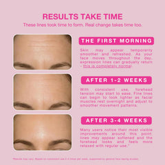 Natsu patch applied to forehead demonstrates discreet overnight wrinkle care.