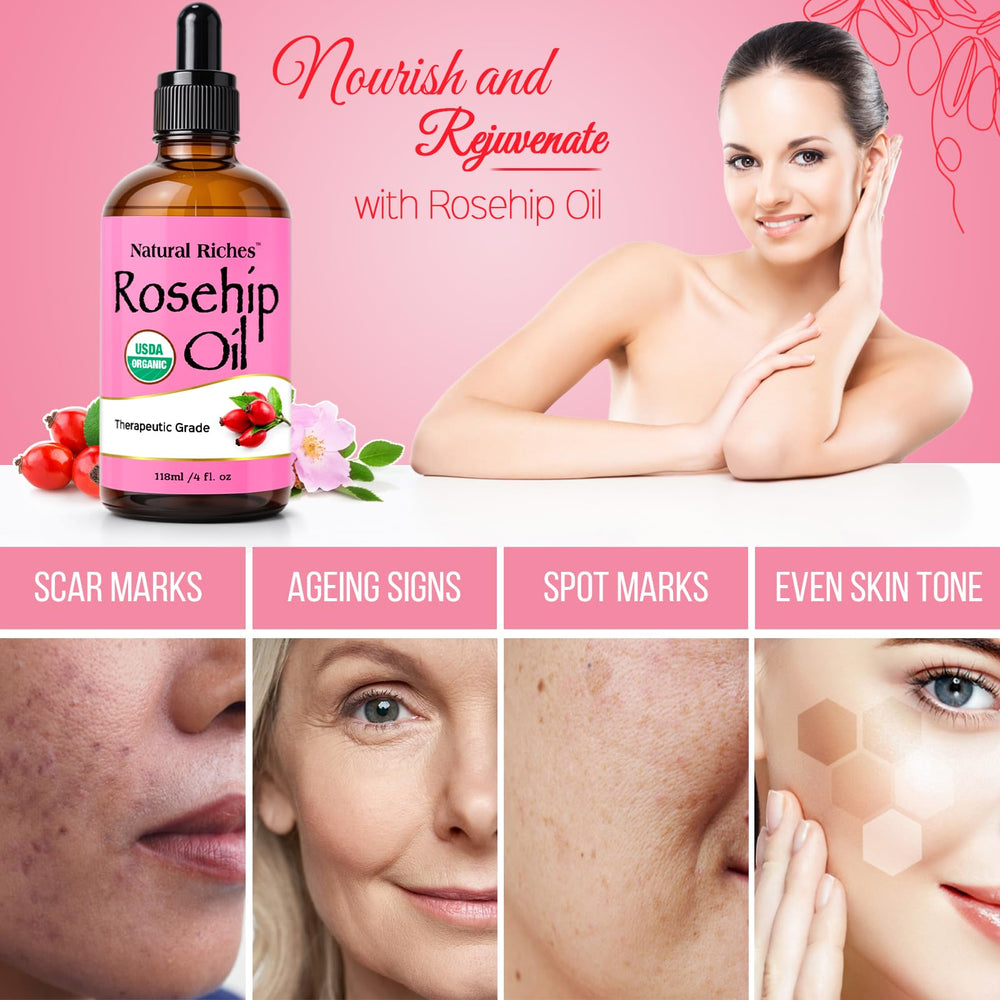 Natural Riches Rosehip Seed Oil glow demonstrates luminous skin after routine.