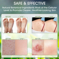 Natural Tea Tree Soap Bar daily use promotes a fresh, clean feeling.