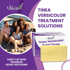 Naturasil Tinea Versicolor soap after-use sun exposure for pigment balance.