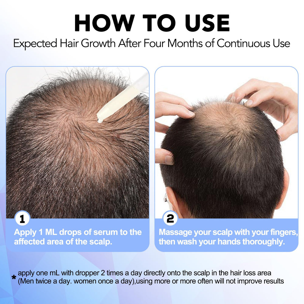 Nature Ziran Minoxidil 5% packaging box shown for easy storage