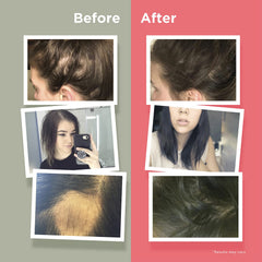 Naturenetics HairAnew packaging to illustrate a complete hair health solution.