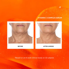 Naturium Vitamin C Complex Serum packaging highlighting jumbo bottle size