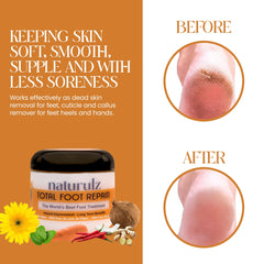 Naturulz Total Foot Repair jar dispense demonstrates easy daily application for dry feet