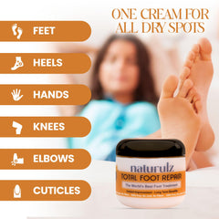 Naturulz Total Foot Repair before-use foot close-up shows dry, cracked heels