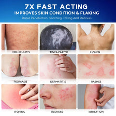 Nedtol Folliculitis Treatment Cream jar shows a non-greasy, moisturizing formula for daily care.