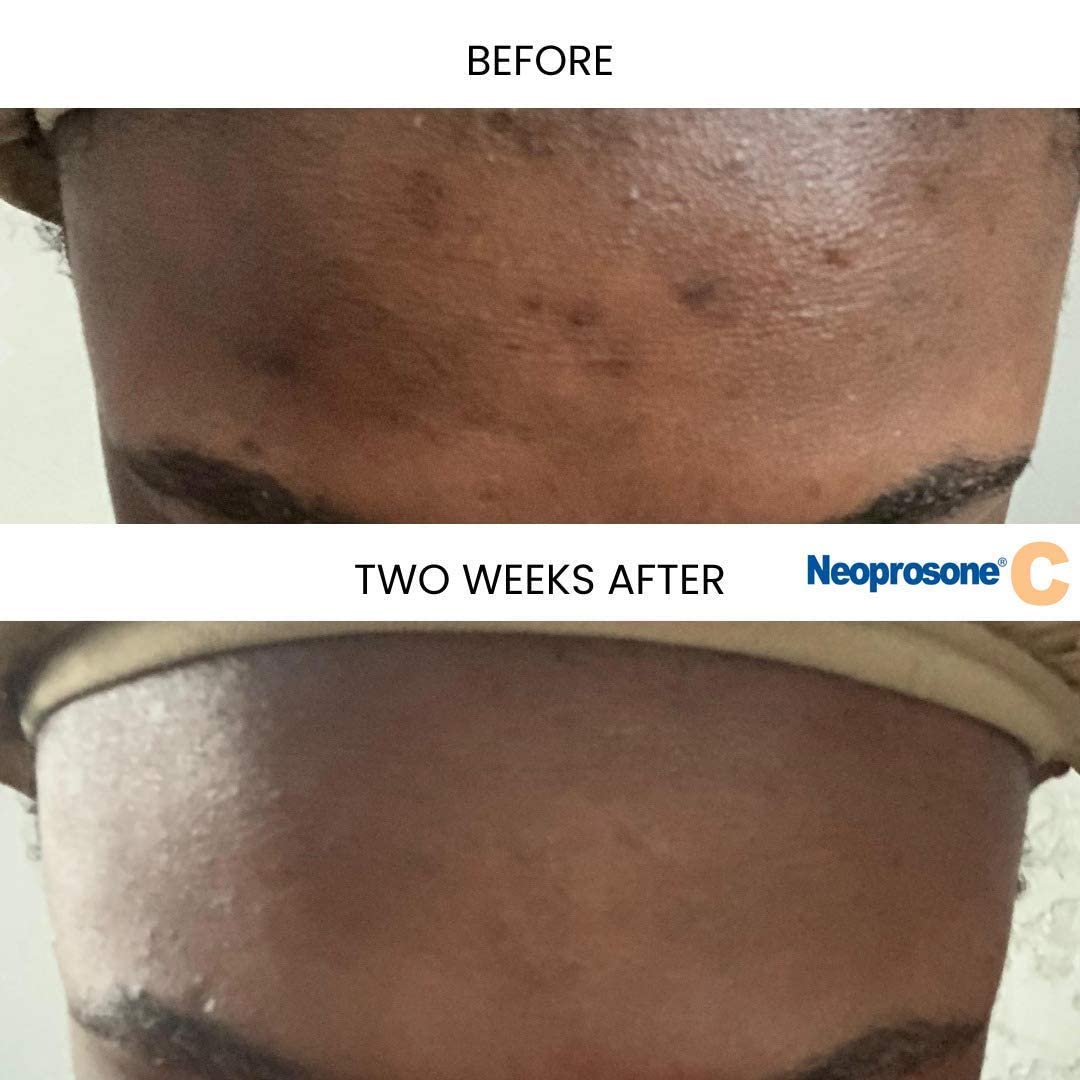 Dropper detail illustrating precise nightly application with smooth serum flow.