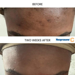 Dropper detail illustrating precise nightly application with smooth serum flow.