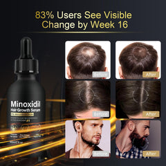 NETYIYUN hair growth serum packaging displays full 2 oz bottle and ingredients.
