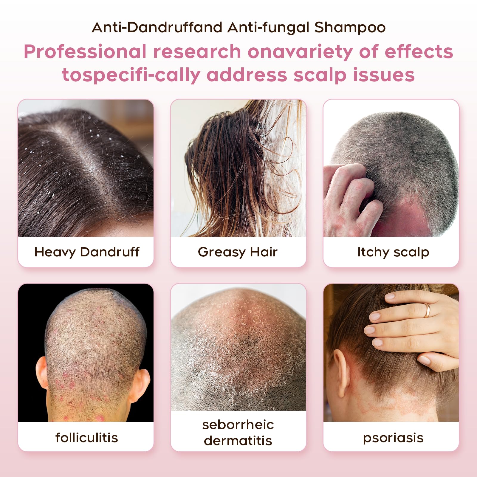 NEWREY herbal-enriched formula highlights soothing root extracts for scalp calm.