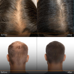 NHTLab Hair Growth Serum with caffeine and biotin for energized roots