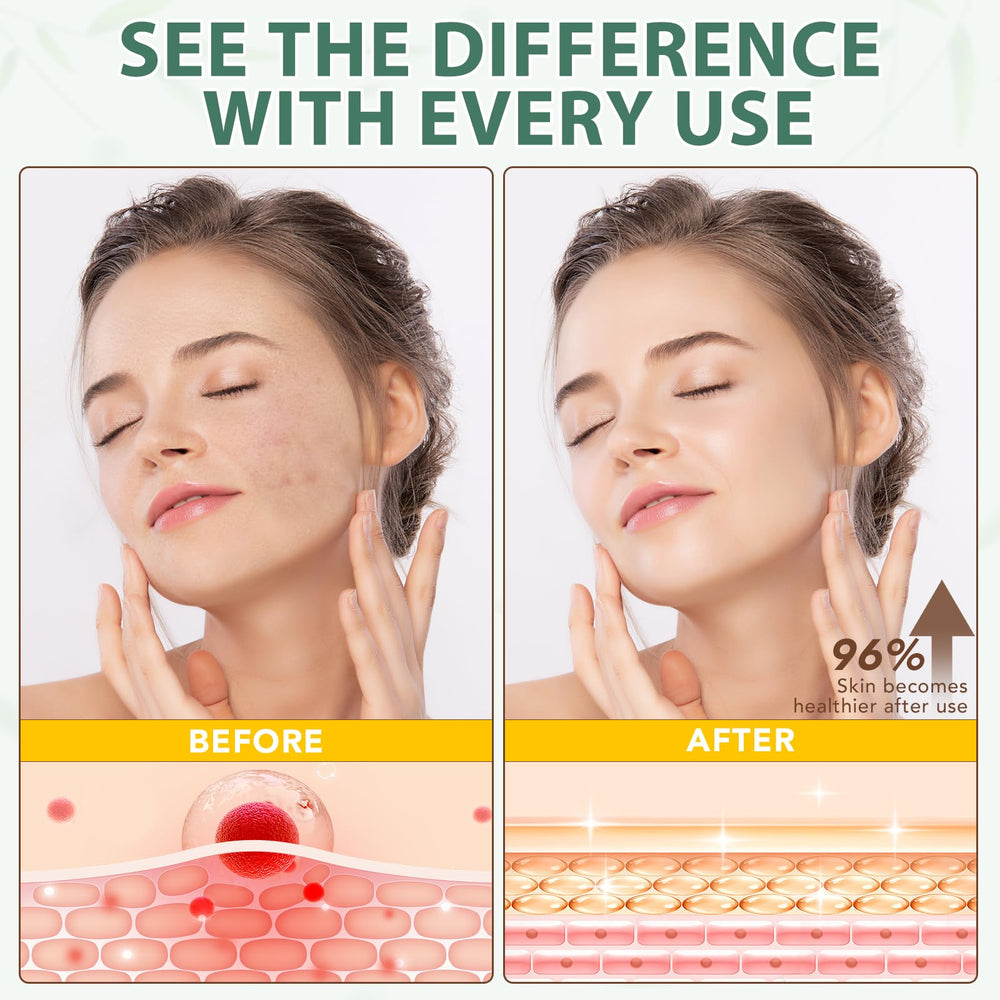 NIFEISHI Face and Body Moisturizer application demonstrates deep hydration for soft skin.