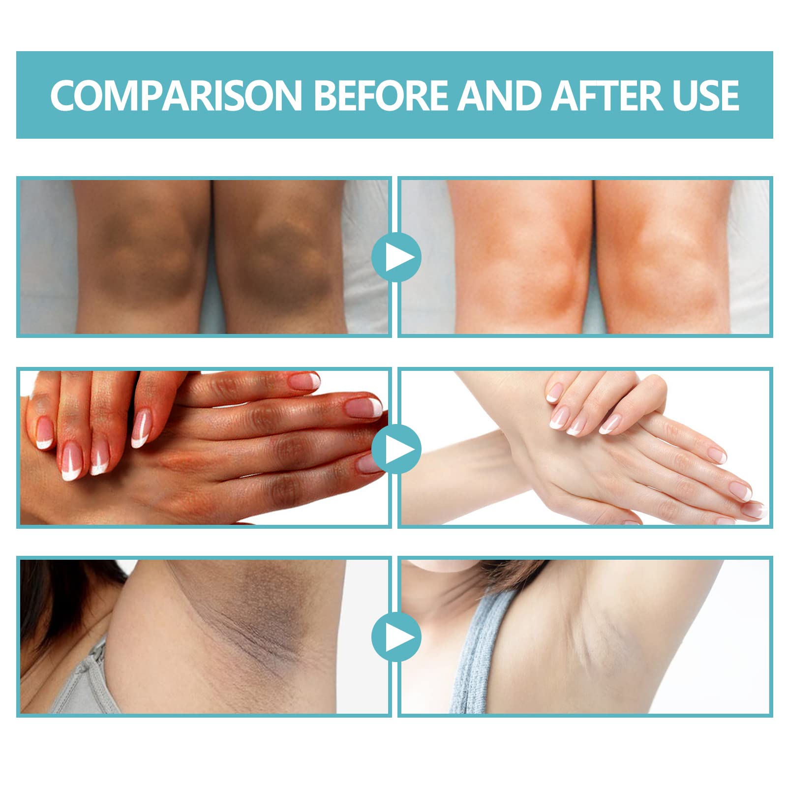 Nigrifix areola and neck area use demonstrates gentle daily skin care