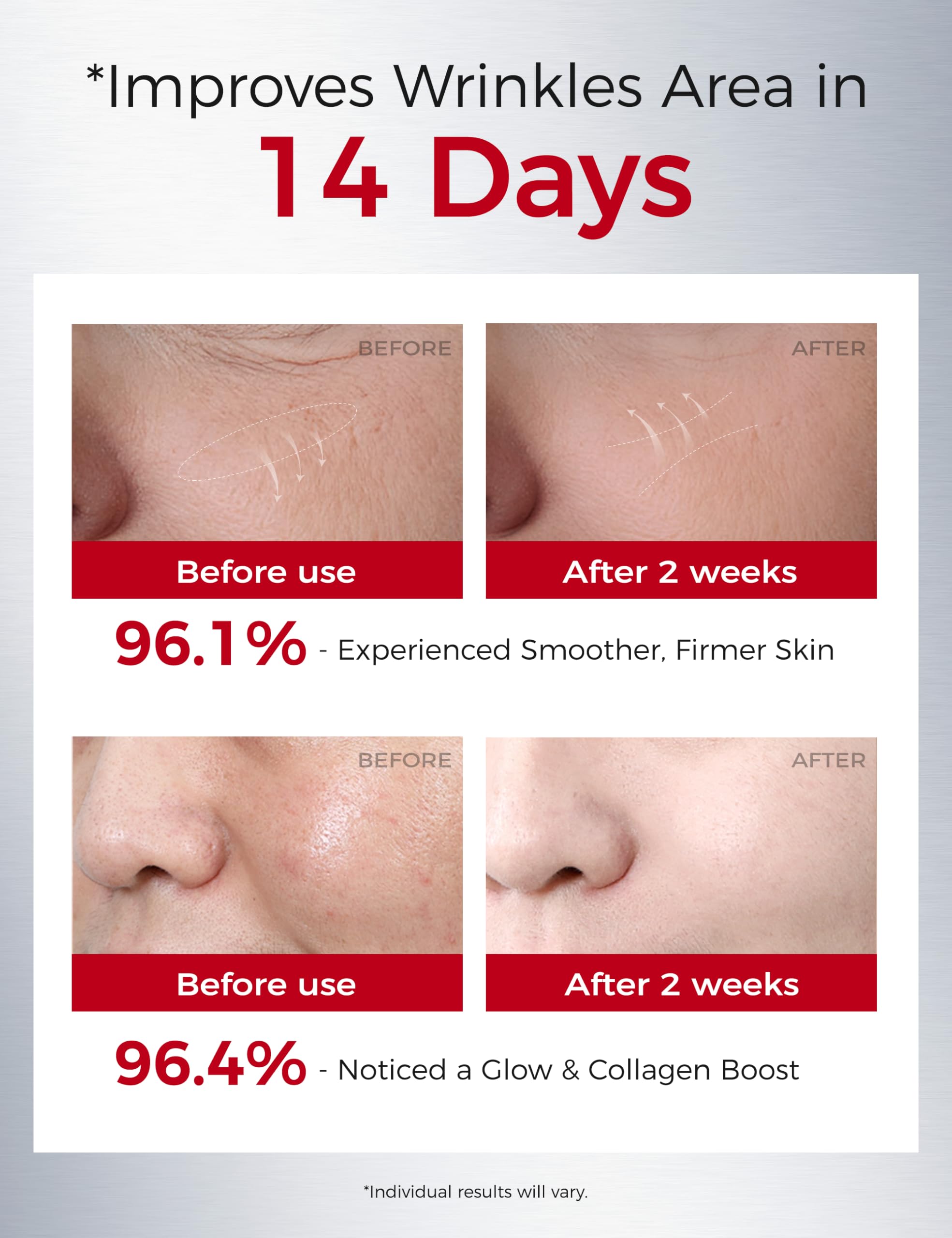 The ingredients panel emphasizes peptides and Pro-Xylane in the Ning Dermologie formula.