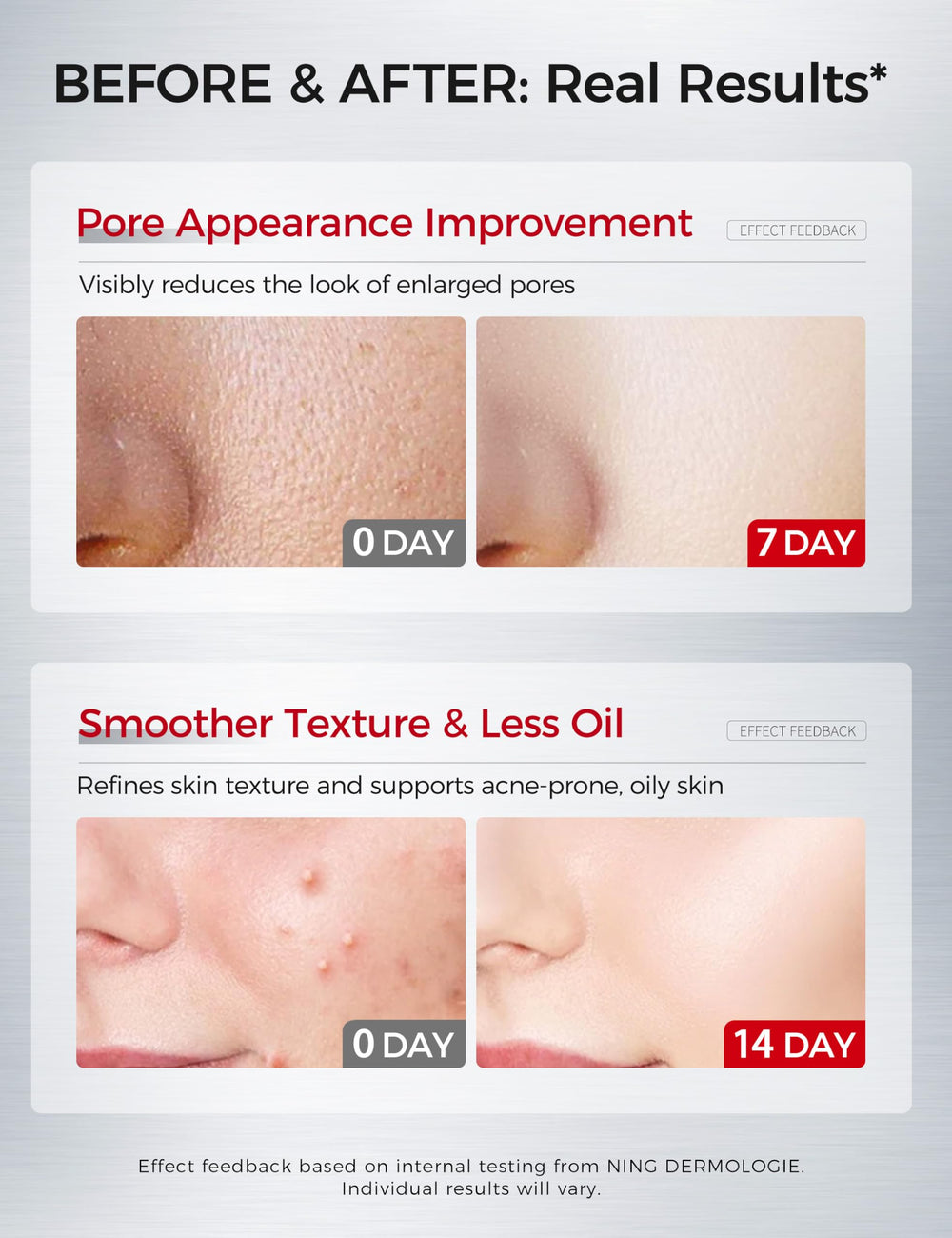 Serum bottle with niacinamide and tranexamic acid for tone balance