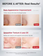 Serum bottle with niacinamide and tranexamic acid for tone balance