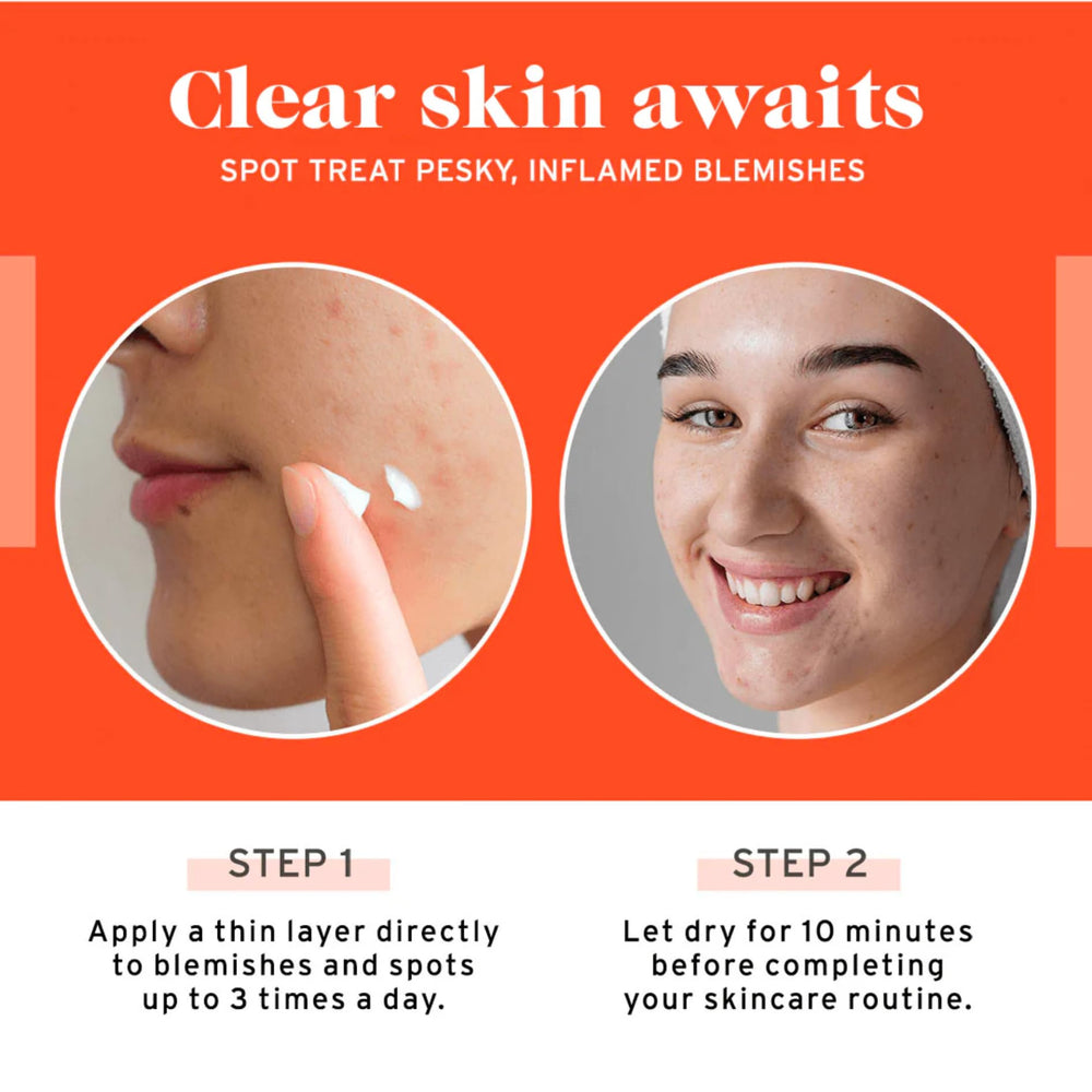 No Bad Stuff 2-percent salicylic acid close-up targets breakouts at the source
