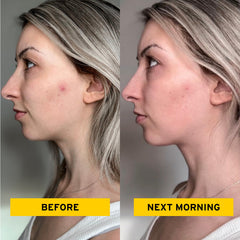 No Bad Stuff night patch overnight for continuous blemish care.