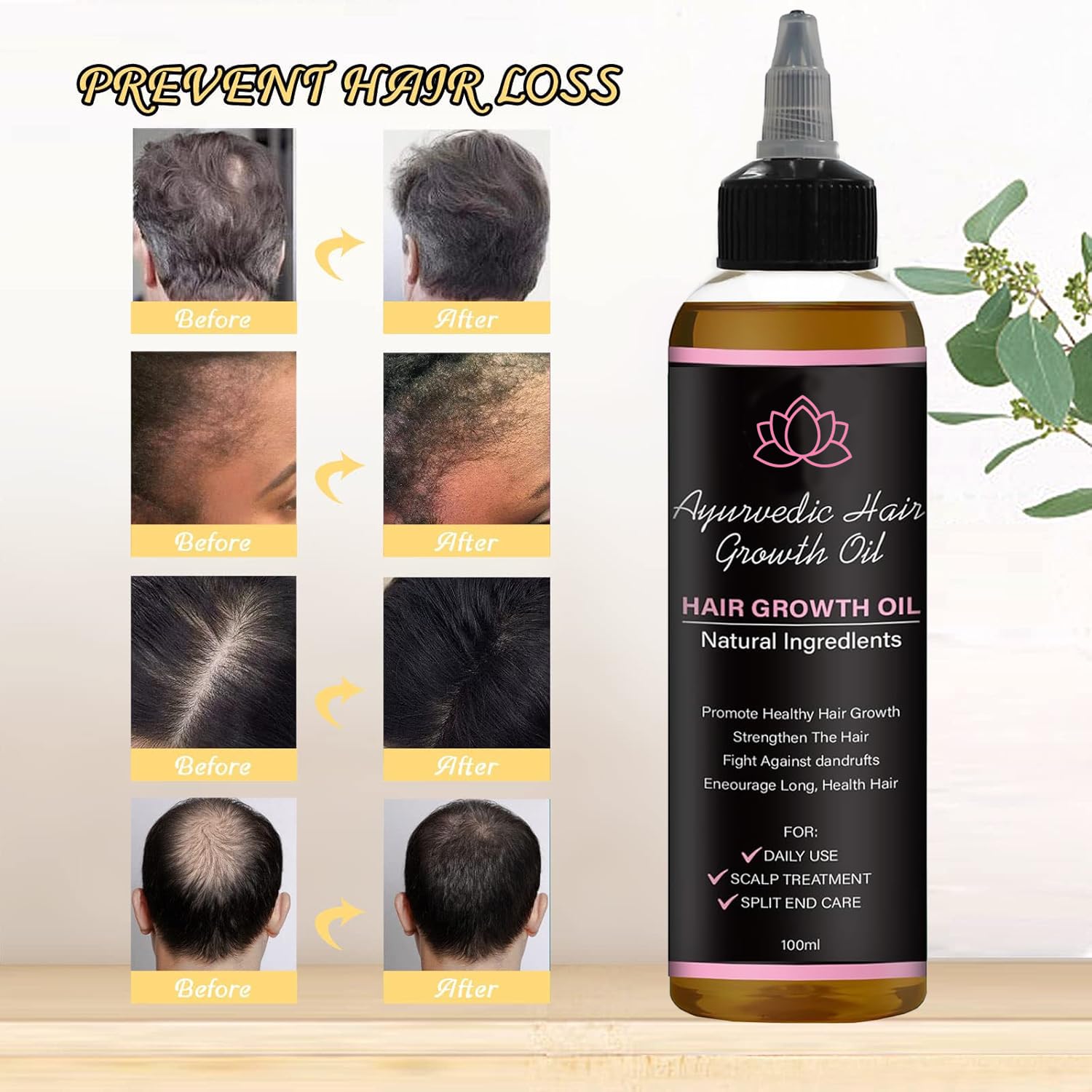 NO BALD Lifewitqueenp Texture after use suggests reduced dryness and improved sheen.