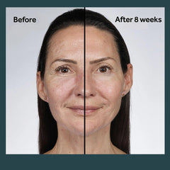 No7 Future Renew night cream for dry skin delivers overnight hydration