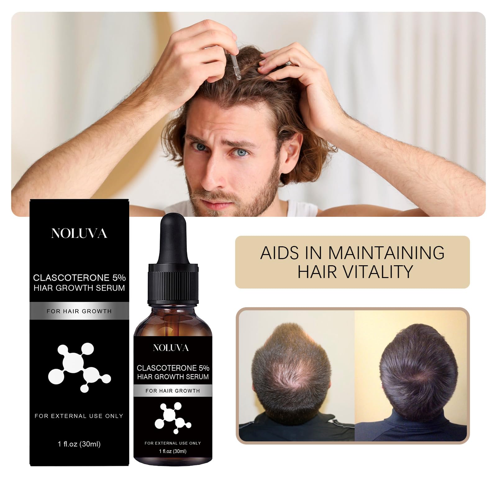 User applying CLASCOTERONE 5% serum during daily routine.