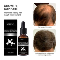Clinical trial chart illustrating increased hair metrics with CLASCOTERONE 5%.