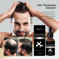 NOLUVA CLASCOTERONE 5% vial showing Vitamin D and Biotin blend for scalp support.