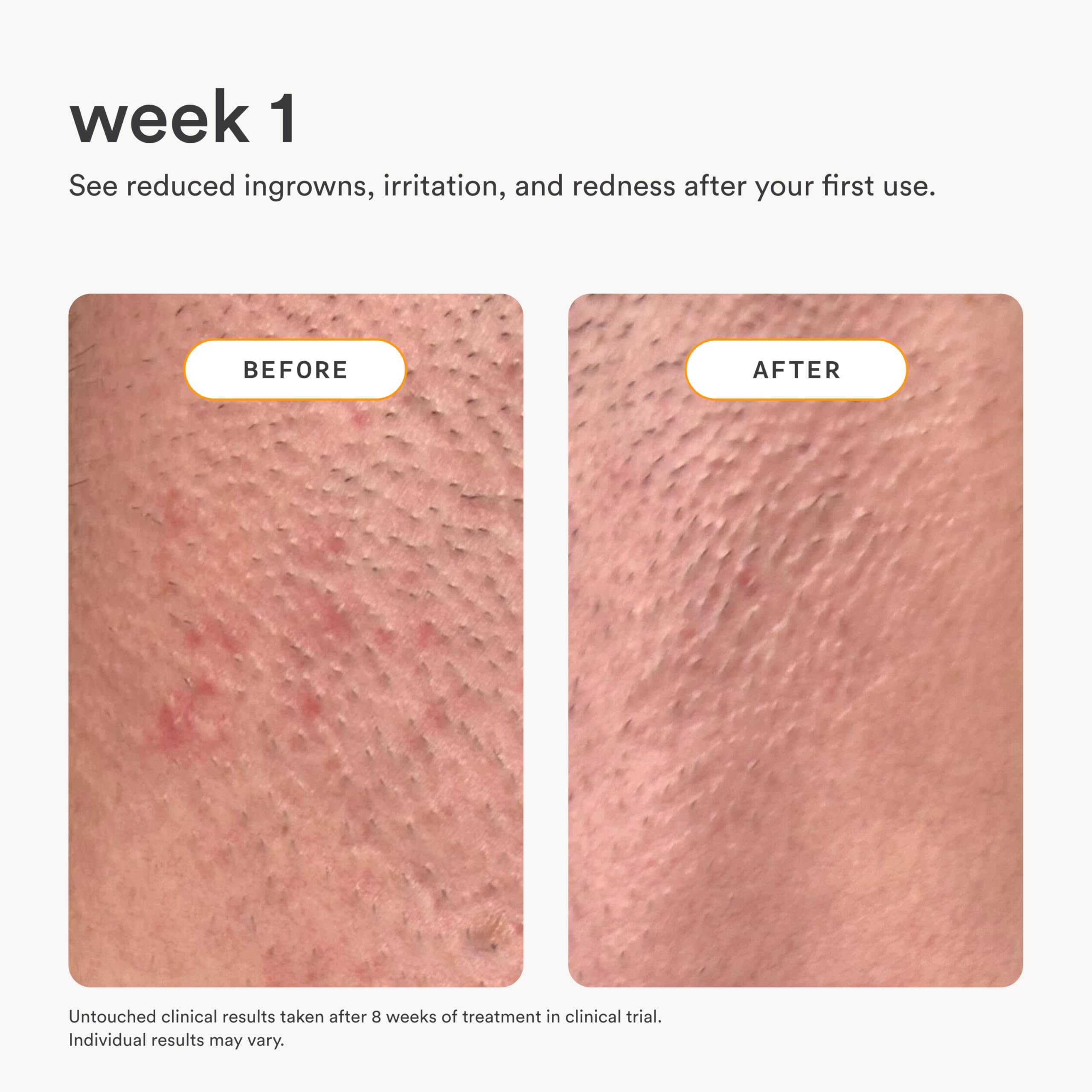 Nood Serum suitable for all areas and skin types.