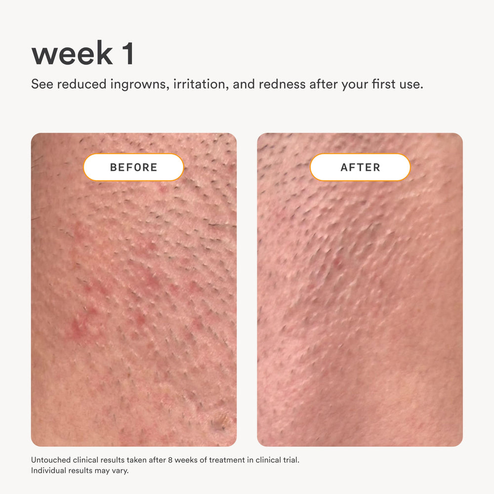 Nood Serum suitable for all areas and skin types.