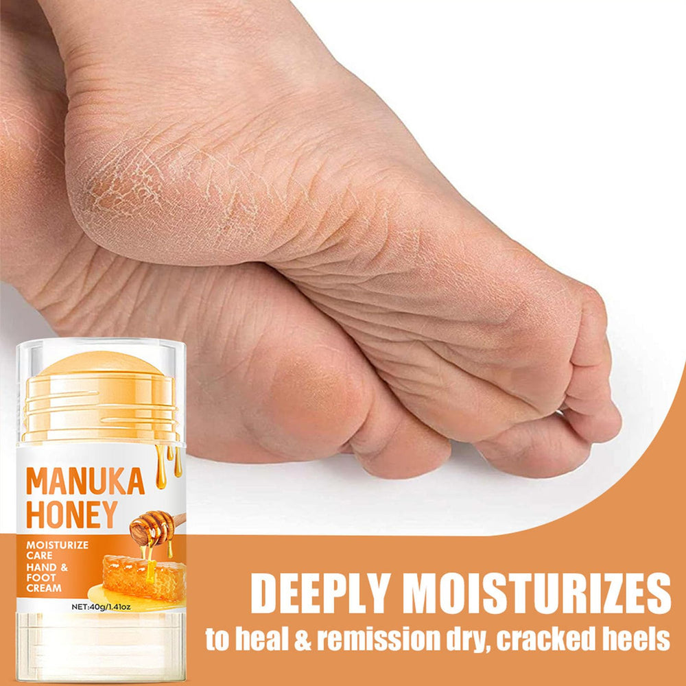 NovaCharm being applied to heel to soften and hydrate dry skin